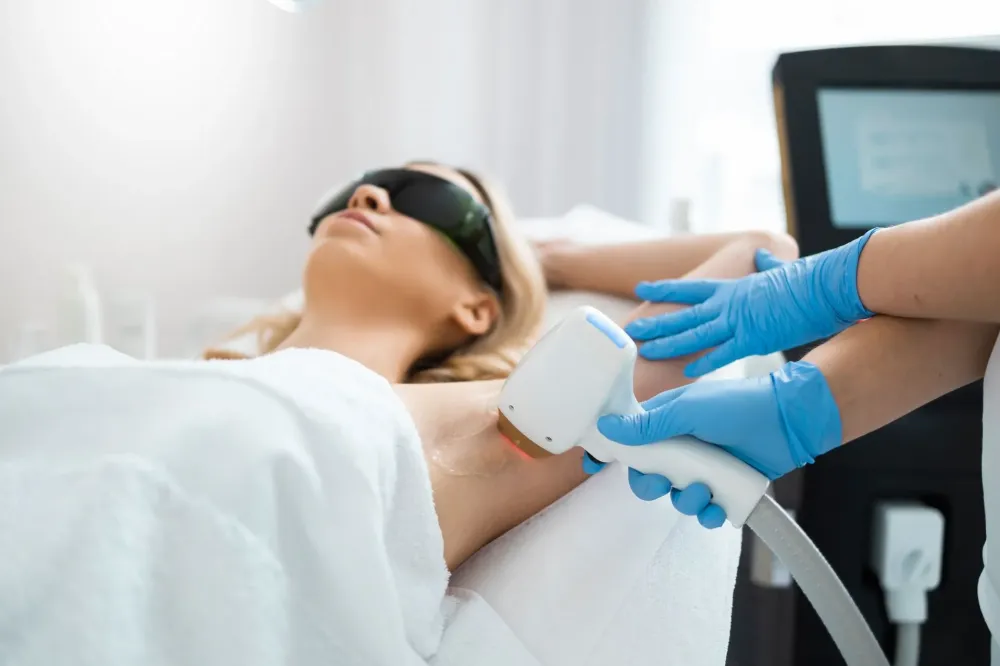 Épilation laser à Avignon